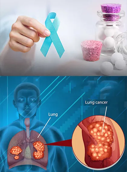 Homeopathy Doctor for Cancer in Mumbai